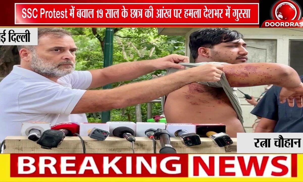 SSC छात्र प्रदर्शन पर विवाद, घायल छात्र को लेकर उठे सवाल